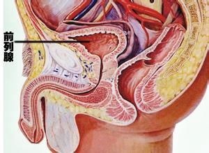 慢性前列腺炎的癥狀及其影響，慢性前列腺炎的癥狀及影響概述